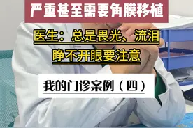 畏光、流泪、睁不开眼需要注意啦 #涨知识 #角膜炎 #结膜炎 #硬核健康科普行动 #超级搜索日视频封面