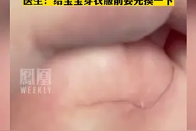 半岁女婴哭闹不止，医生从脚底取出4cm头发。#热点知多少视频封面