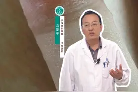 手上长这种密集小水泡，就别做家务了！#接触性皮炎 #医学科普 #洗涤剂 #抖出健康知识宝藏