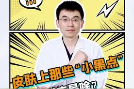 皮肤上那些“小黑点”，到底是啥啊？ #黑色素痣 #黑色素瘤 #痣 #斑块 #抖出健康知识宝藏