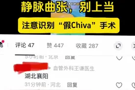 静脉曲张，别上当，注意识别假Chiva手术#静脉曲张 #chiva #医学科普 #血管外科王谦医生