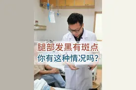 腿部发黑有斑点 你出现过这种情况吗？ 腿部发黑有斑点 你出现过这种情况吗？#硬核健康科普行动 #医学科普 #静脉曲张 #腿部发黑 视频封面
