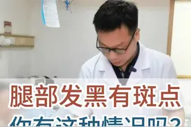 腿部发黑有斑点 你出现过这种情况吗？ 腿部发黑有斑点 你出现过这种情况吗？#硬核健康科普行动 #医学科普 #静脉曲张 #腿部发黑 视频封面