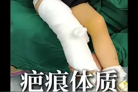 冷知识！疤痕和缝合线的粗细无关，与体质有关！ #疤痕 #疤痕体质 #缝合 #留疤体质 #医学科普视频封面