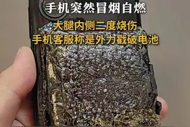 #男子回应手机放腿下自燃被烧伤 ：大腿内侧二度烧伤 手机客服称是外力戳破电池 #手机 #手机电池 #自燃视频封面