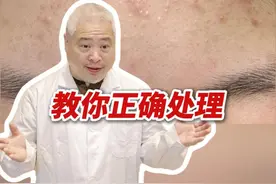 脸上长闭口，密密麻麻一片很难看，三甲医生教你正确处理！ #涨知识 #医学科普 #抖出健康知识宝藏   #闭口 #颜值视频封面