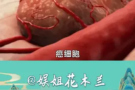 大爷终于以一种奇怪的方式战胜了癌细胞 #搞笑 #万万没想到 #健康 #癌症