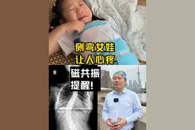 这10岁以下的脊柱侧弯案例，磁共振提醒！ 首先这个幼儿型脊柱侧弯发病率不是很高。针对这个小女娃的情况，需要知道的事
一定要治疗，不仅要治，还要多一个心眼，这个侧弯到底是什么原因造成的。强烈建议完善检查，多做一个磁共振，需要排除的是，有没有脊髓方面的问题，比如脊髓空洞症，CHIARI畸形，以及脊髓栓系。如果说没有这些情况，就谢天谢地。如果有，还要交给神经外科，进一步治疗原发病。如果有认识这位妈妈的网友，请帮忙转述一下。
另外，孩子现在戴的这个支具，矫正效果很一般。比如说：到我门诊治疗的病人，对支具要求更高，40度的侧弯，最起码要矫正一半才行，也就是孩子带着支具再拍片，是20度左右。
关于康复训练，这个年龄的孩子做康复，成功的概率很低，视频也能看到，孩子做这些猎鸟狗式训练动作，很努力，但是动作不稳也很难达到标准，所以我认为很难帮她达到治疗效果。#脊柱侧弯 #罗义医生 #硬核健康科普行动  #医学科普视频封面