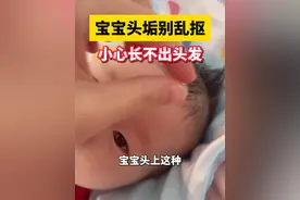 宝宝头上的头垢别去抠，医生教你温和去除！ #头垢 #宝宝 #秃头 #科普 #宝妈视频封面