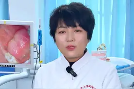 #口腔科普 #牙片 #根尖周炎 牙龈肿痛怎么办？？？