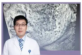 如果你不幸，已经反黑了，那就请你认真按这三步骤去修复！#黄褐斑#谣零零计划#女性健康计划@抖音辟谣 视频封面