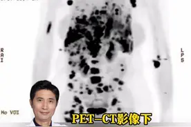 3D成像下看肺癌晚期骨转移 #硬核健康科普行动  #医疗健康创作训练营 #肺癌晚期 #肺癌晚期骨转移 #医学知识科普视频封面