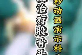 冲击波治疗股骨头坏死，30秒动画演示科普讲解 #健康 #骨坏死视频封面