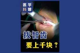 拔智齿要上千块？ #硬核健康科普行动 #医学科普 #智齿 #种植牙 #北京视频封面