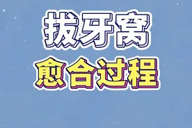 拔牙后，什么样的拔牙窝是正常的？ #拔牙 #医学科普 #牙医日常 #新年愿望吃好玩好视频封面