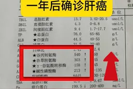乙肝转氨酶升高不以为然，哎！一年后确诊肝癌！ #肝功能 #医学科普 #肝癌 #山东视频封面