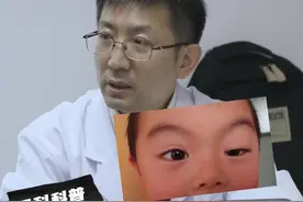 孩子眼皮睁不开，要不要治疗？眼科医生上睑下垂全解析 类型、影响与治疗时机#医学科普 #眼科 #上睑下垂 #先天性上睑下垂视频封面