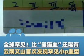 全球罕见！比“熊猫血”还稀有，云南文山首次发现罕见小p血型#大象主播说 @主持人嘉祥视频封面