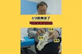1/3距骨没了，疼的厉害需要做融合 #医学科普 #硬核健康科普行动视频封面