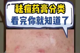 祛痘药膏分两种，一个视频讲清楚#医学科普 #皮肤 #痘痘 