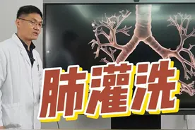 肺灌洗分为两大类：气管镜下肺灌洗、大容量全肺灌洗。 肺灌洗的方法根据灌洗范围、灌洗量和麻醉操作法有所不同，目前肺灌洗可以分为两大类：
1.经支气管镜支气管肺泡灌洗术；
2.经双腔管大容量全肺灌洗术；
#肺灌洗 #肺灌洗手术 #全肺灌洗 #全肺灌洗术 #龙飞院长视频封面