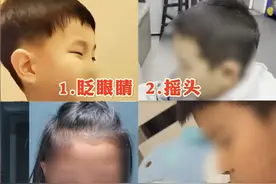 孩子抽动症，有以下四种症状 #抽动症 #医学科普 #健康 #科普视频封面