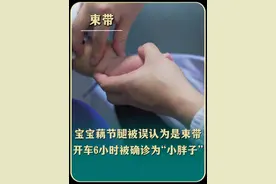 宝宝手上腿上一节一节的，像莲藕。家长担心是束带 开车6小时到门诊被医生确诊位“小胖墩”#束带综合征 #硬核健康科普行动  #医疗科普创作训练营 #育儿经验分享