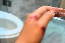 万幸！女子洗澡时浴室玻璃门爆裂，手臂上多处被划伤流血，当事人： 很幸运没有造成严重伤害，才知道很多人有过同样的经历。#浴室玻璃门 #惊险视频封面