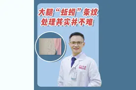 这还真是一种怪烦人的皮肤病咧...你大腿内侧有这种蚯蚓状条纹吗？#医学科普视频封面