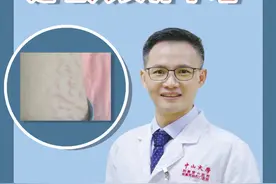这还真是一种怪烦人的皮肤病咧...你大腿内侧有这种蚯蚓状条纹吗？#医学科普视频封面