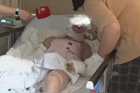 电动车行驶中自燃 ，11岁脑瘫男孩严重烧伤，提起手术孩子情绪很激动，“他从小扎针扎怕了 非常害怕”#河南dou知道 #烧伤视频封面