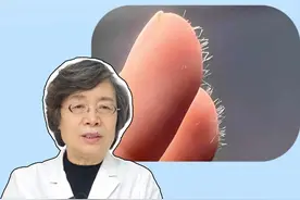 手上感觉扎了刺却找不到，也很难弄出来，可能是扎到玻璃纤维了，医生教你如何处理！#科普 #生活小妙招 #健康 #扎刺 #涨知识视频封面