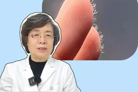 手上感觉扎了刺却找不到，也很难弄出来，可能是扎到玻璃纤维了，医生教你如何处理！#科普 #生活小妙招 #健康 #扎刺 #涨知识视频封面