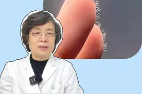手上感觉扎了刺却找不到，也很难弄出来，可能是扎到玻璃纤维了，医生教你如何处理！#科普 #生活小妙招 #健康 #扎刺 #涨知识视频封面