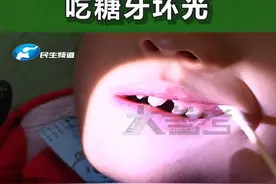 河南郑州：3岁萌娃就“烂”牙？不单单是因为糖吃多了#萌娃 #糖 #牙齿 #河南dou知道 视频封面
