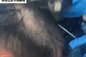 男子为藏毒专门剃地中海发型 19包可卡因藏在假发片中被查出 价值人民币7.6万元#藏毒 #机场 #哥伦比亚视频封面