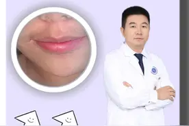 唇周长小胡子的女生，提醒你要注意自己的卵巢了#女生长胡子 #多囊卵巢综合症 #月经不规律 #抖出健康知识宝藏视频封面
