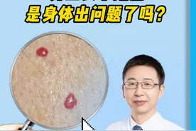 家里老人身上长这种小红点，是身体出问题了吗？#樱桃状血管瘤 #医学科普 #硬核健康科普行动视频封面