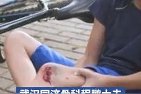 骑自行车撞到柱子摔了腿,半月板会受伤吗 #摔伤  #骑行  #半月板损伤 #硬核健康科普行动