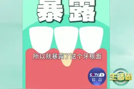 【照照镜子！#牙缝出现黑三角警惕牙龈萎缩 】照镜子时，若发现牙齿之间出现“黑三角”，这可能是因为牙龈炎症导致牙龈萎缩，牙齿缝隙变大。“黑三角”不仅会让食物嵌塞，还影响美观与发音，千万别忽视，要尽快就医！视频封面