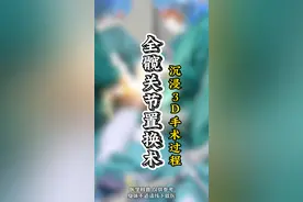 全髋关节置换术 沉浸3D手术过程 #健康 #骨坏死 #全髋关节置换视频封面