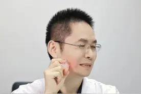 智齿发炎肿痛怎么办，医生来给你支招！#智齿 #发炎 #口臭 #聚维酮碘含漱液 #硬核健康科普行动视频封面