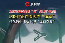 30厘米活黄鳝“钻”进男子肠道，送医时正在腹腔内“游动”，怀化医生成功上演“虎口夺食”#怀化 #突发 #手术