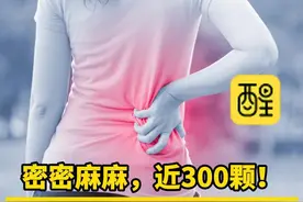密密麻麻，近300颗！女子关节内取出大小不一软骨瘤 关节里仿佛灌了泥沙，每一步都像在碎石堆里挪动。（编辑：黎晓彤；责编：谭泳欣；素材来源：广州日报）#健康 #万万想不到 #社会百态 #热点 #奇葩 女子误踩捕兽套苦撑2小时视频封面