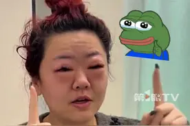 女生狂炫数斤车厘子后发烧，眼睛因药物过敏肿成“悲伤蛙”。医生提醒车厘子属热性水果，应适量食用。#女生狂炫数斤车厘子后肿成悲伤蛙 #车厘子 #万万没想到视频封面