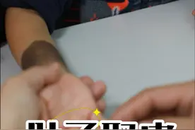 孩子手臂上长有黑痣，需要从孩子腹部植入皮肤扩张器，以便获取额外的皮肤来覆盖手臂上的黑痣区域并进行修复。#黑痣 #扩张器手术 #手臂黑痣 #硬核健康科普行动  #刘新海医生视频封面