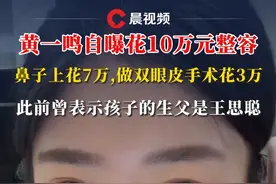 黄一鸣自曝花10万元整容， 鼻子上花7万，做双眼皮花3万，此前曾表示孩子生父是王思聪 #黄一鸣花10万整容  #黄一鸣  #王思聪