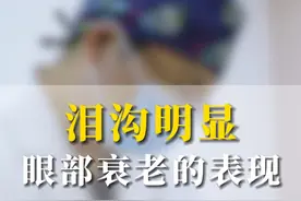 泪沟明显 眼部衰老的表现 #整形医生蒋威 #西安同城 #注射美容 #医疗美容 #泪沟视频封面