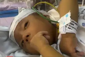 网民牵挂的广西平南4月大“小黄人”宝宝，今天（29日）中午已转运至北京儿童医院求医#广西小黄人千里转运北京  #广西小明千里转运换肝 #广西4月大婴儿小明转运北京 #广西dou知道视频封面