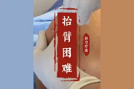 抬臂困难，手臂伸不直，可能是冈上肌腱损伤了，小针刀治疗 #小针刀 #手臂疼痛 #手臂发凉 #针刀王萍 #硬核健康科普行动视频封面